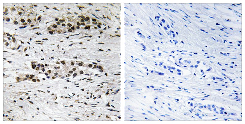 Estrogen Receptor-α (Phospho-Ser102) Antibody