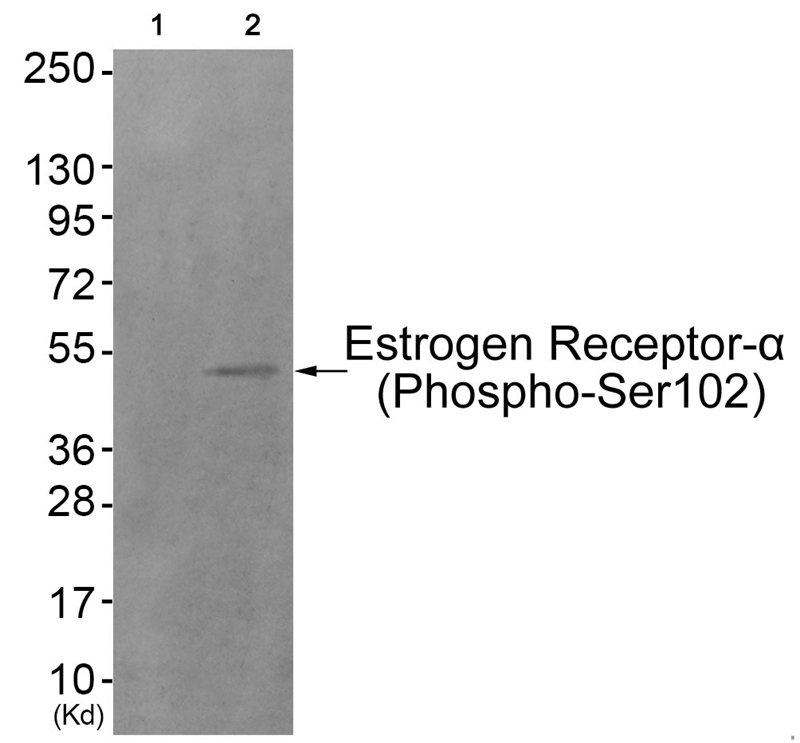 Estrogen Receptor-α (Phospho-Ser102) Antibody