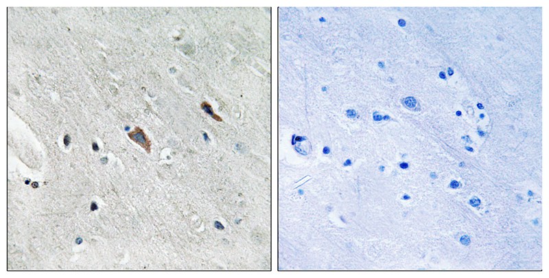 Gab2 (Phospho-Tyr643) Antibody