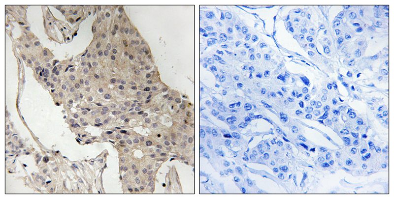 Gab2 (Phospho-Ser623) Antibody