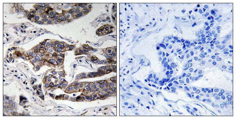 Girdin (Phospho-Ser1417) Antibody