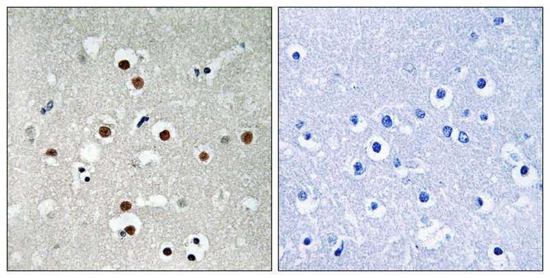 MEF2C (Phospho-Ser396) Antibody