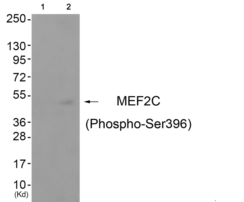 MEF2C (Phospho-Ser396) Antibody