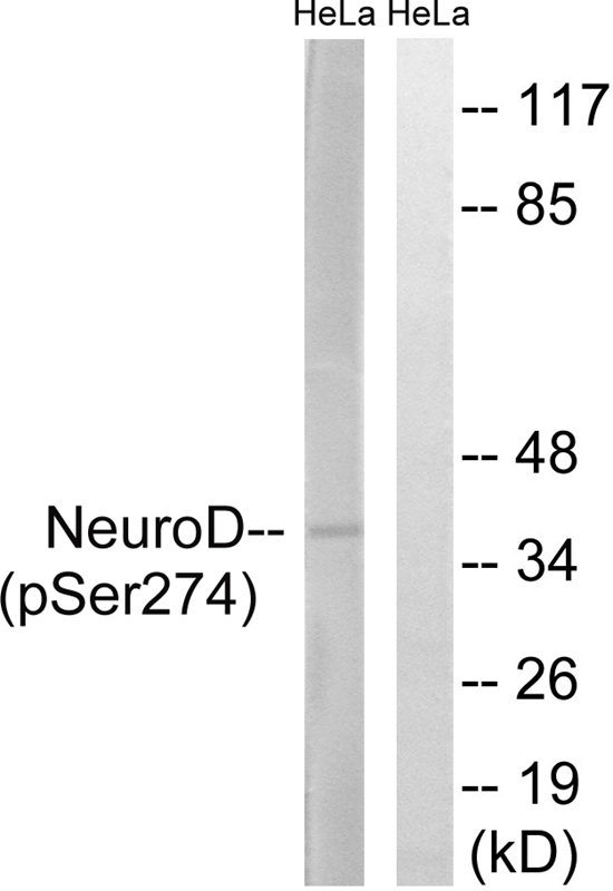 Neuro D (Phospho-Ser274) Antibody