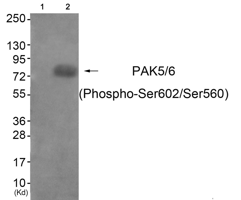 PAK5/6 (Phospho-Ser602/Ser560) Antibody