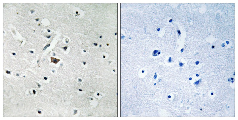 PLD2 (Phospho-Tyr169) Antibody