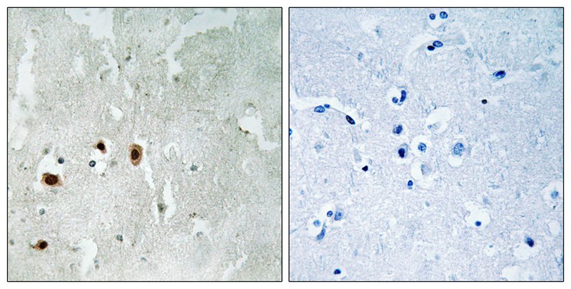 Tip60 (Phospho-Ser90) Antibody