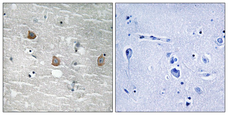 TOB1 (Phospho-Ser164) Antibody