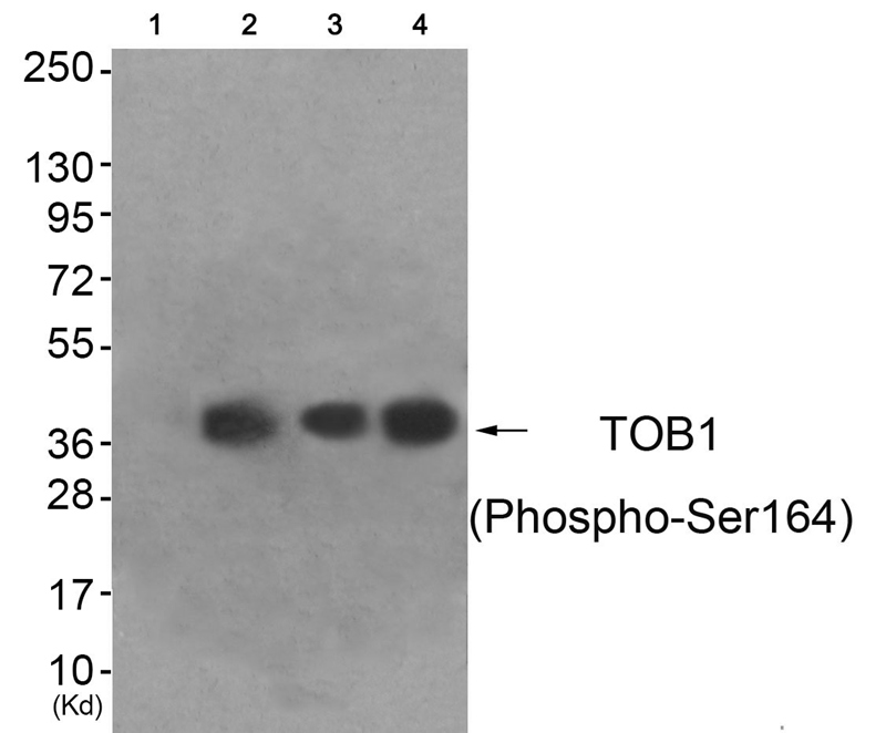 TOB1 (Phospho-Ser164) Antibody