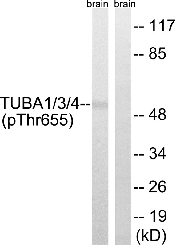 TUBA1/3/4 (Phospho-Tyr272) Antibody