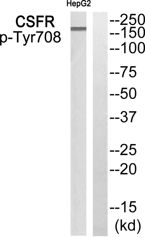 CSFR (Phospho-Tyr708) Antibody