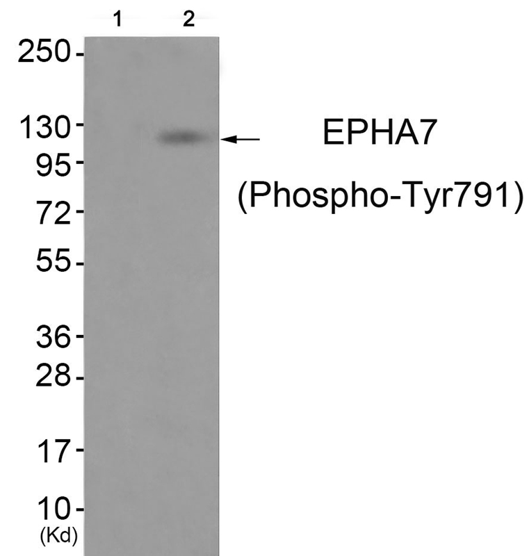 EPHA7 (Phospho-Tyr791) Antibody