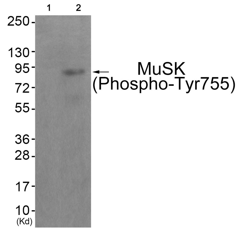 MuSK (Phospho-Tyr755) Antibody