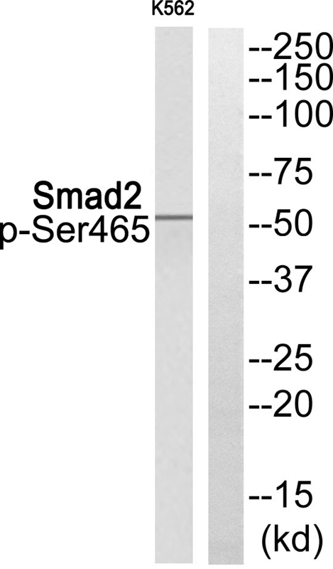 Smad2 (Phospho-Ser465) Antibody