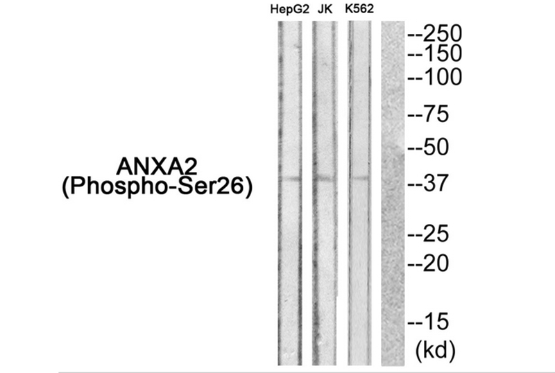 ANXA2 (Phospho-Ser26) Antibody