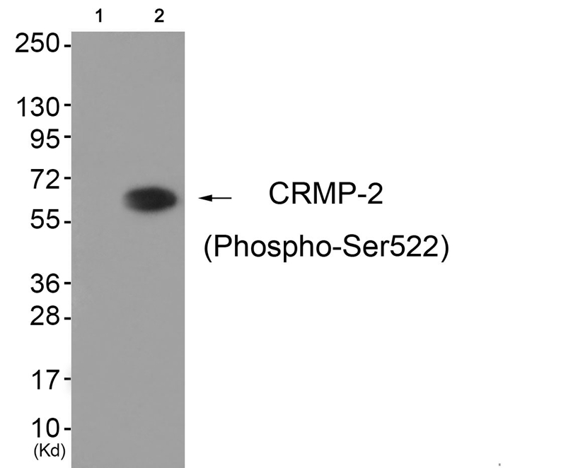 CRMP-2 (Phospho-Ser522) Antibody