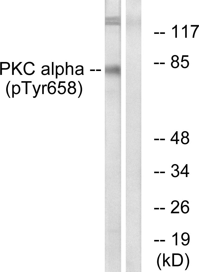 PKC α (Phospho-Tyr658) Antibody