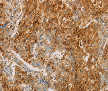 CEACAM8 Antibody