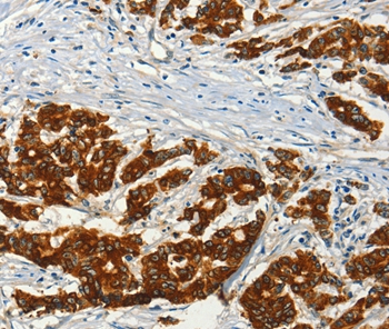 ADCY3 Antibody