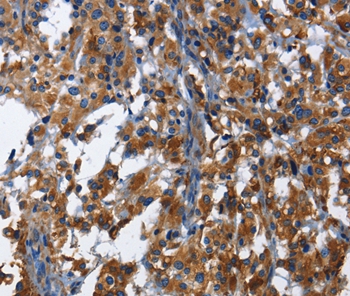 KLRB1 Antibody