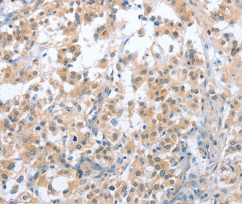 CD200R1 Antibody