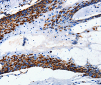 MT-CO2 Antibody