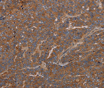 GDF2 Antibody