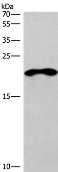 TNFRSF17 Antibody