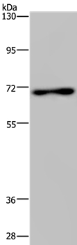 TIPARP Antibody