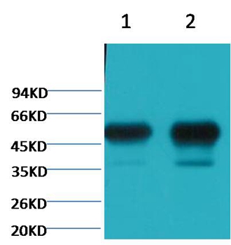 β II tubulin Mouse Monoclonal Antibody (Rodent Preferred)