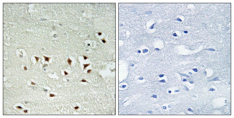 MAPKAPK2 (Phospho-Thr334) Antibody