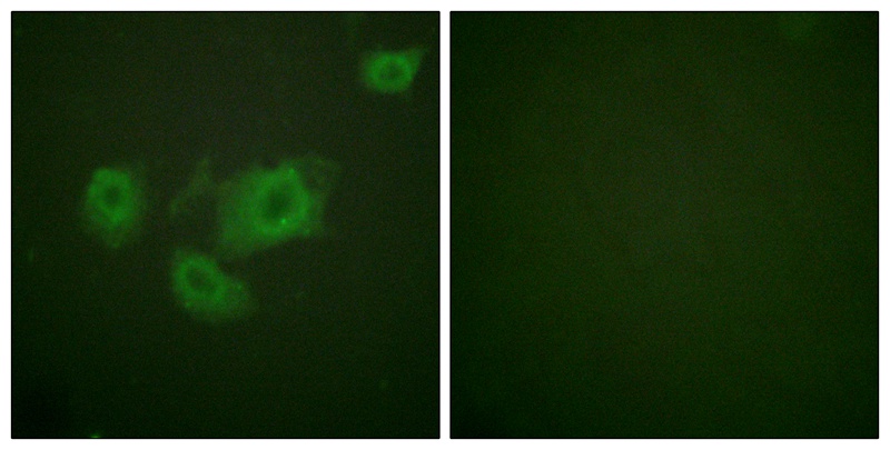 Kir6.2 (Phospho-Thr224) Antibody