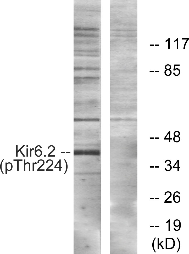 Kir6.2 (Phospho-Thr224) Antibody