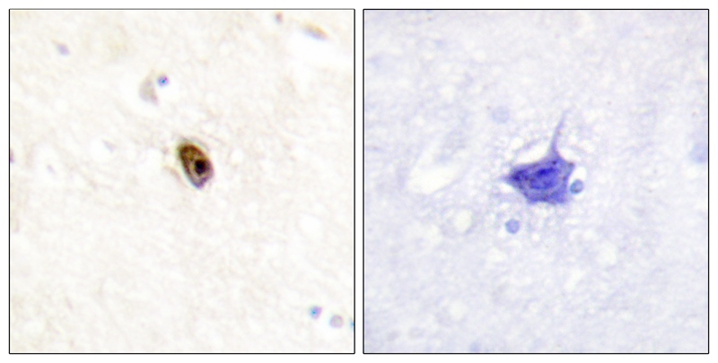 AurB/C (Phospho-Thr236/202) Antibody