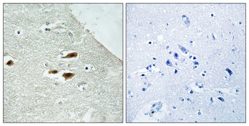 Period Circadian Protein 2 (Phospho-Ser662) Antibody