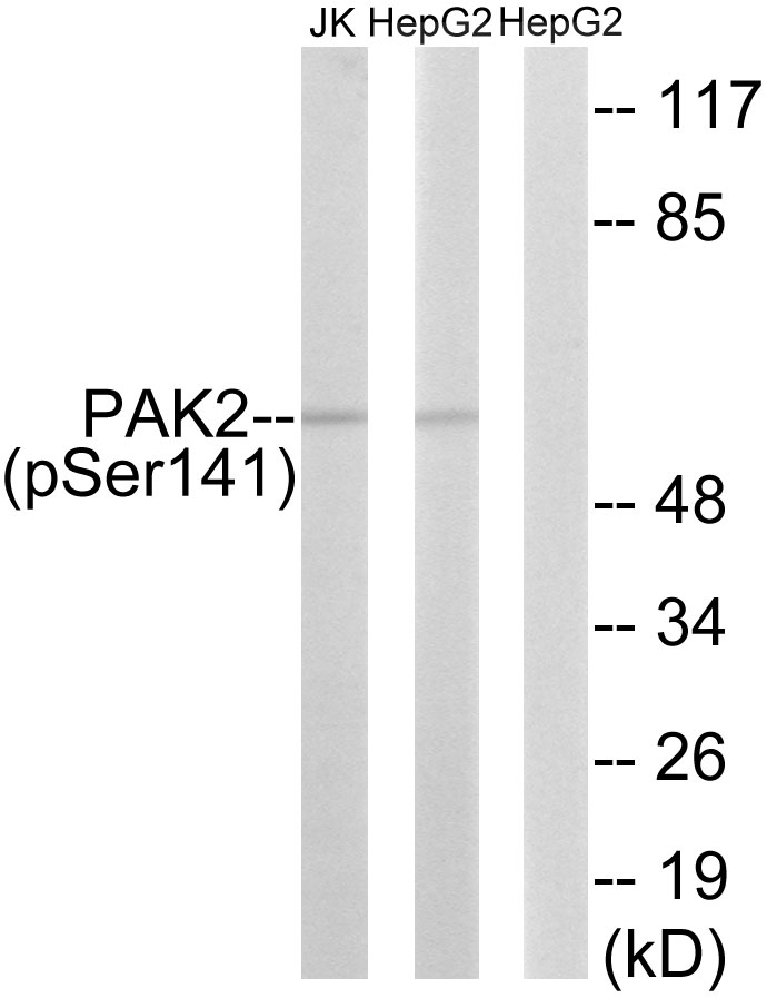 PAK2 (Phospho-Ser141) Antibody 