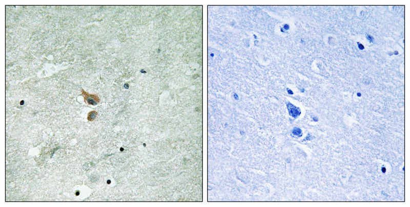 RIPK2 (Phospho-Ser176) Antibody