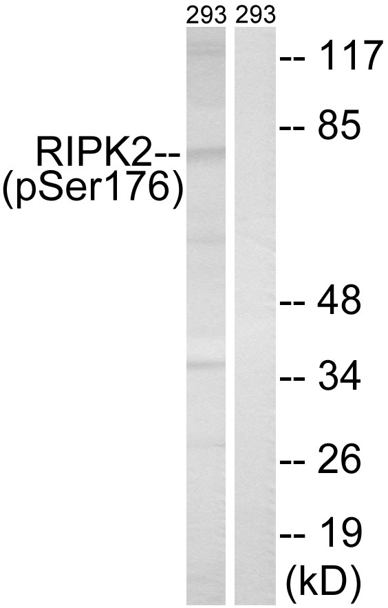 RIPK2 (Phospho-Ser176) Antibody