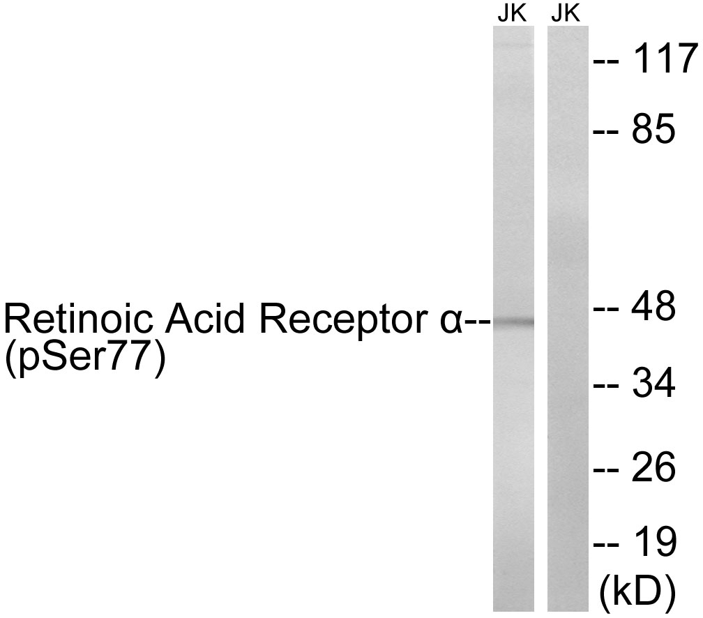 Retinoic Acid Receptor α (Phospho-Ser77) Antibody