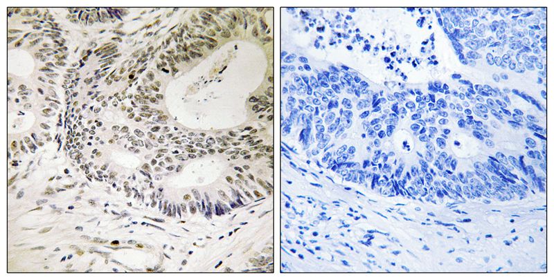 53BP1 (Phospho-Ser25) Antibody