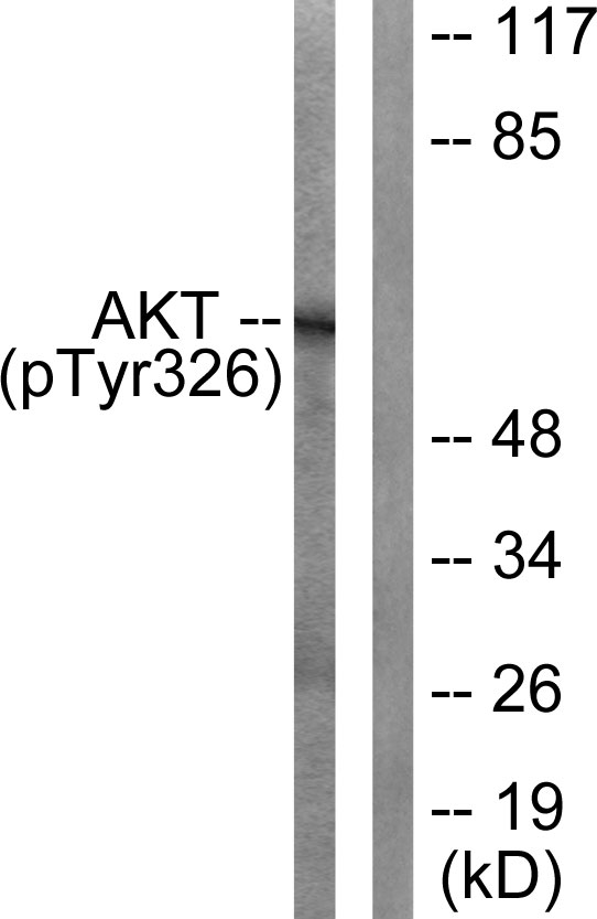 Akt (Phospho-Tyr326) Antibody 