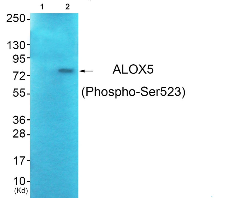 ALOX5 (Phospho-Ser523) Antibody