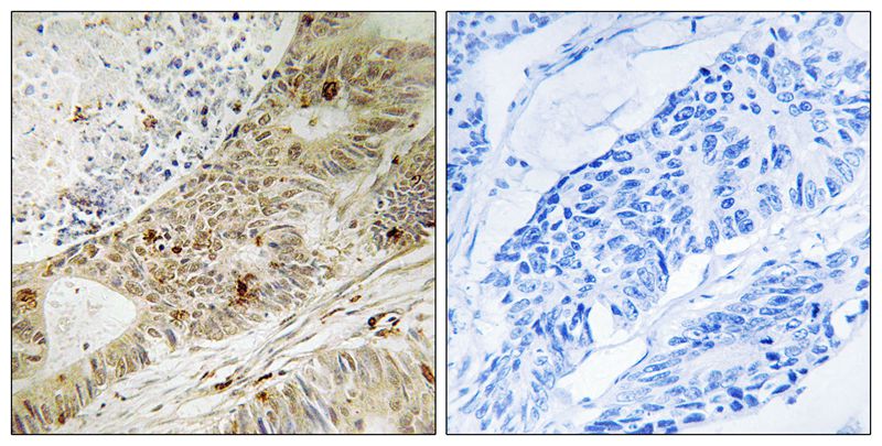 ATRIP (Phospho-Ser224) Antibody