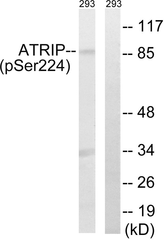 ATRIP (Phospho-Ser224) Antibody