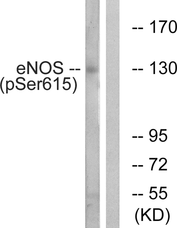 eNOS (Phospho-Ser615) Antibody