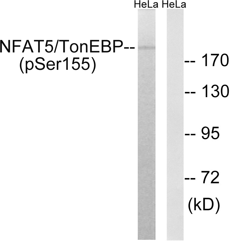 NFAT5/TonEBP (Phospho-Ser155) Antibody