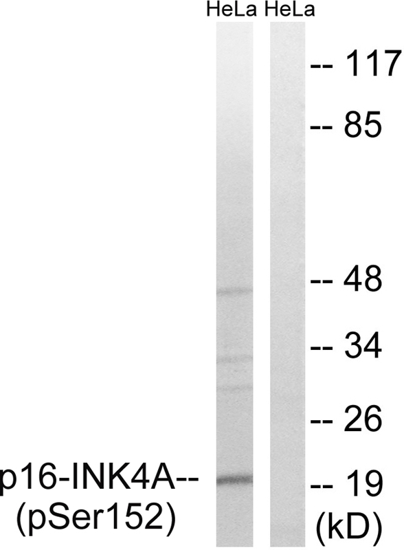 p16-INK4a (Phospho-Ser152) Antibody