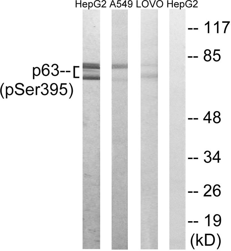 p63 (Phospho-Ser395) Antibody