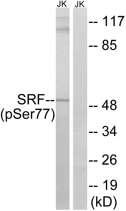 SRF (Phospho-Ser77) Antibody