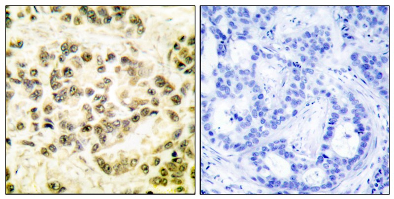 STAT5B (Phospho-Ser731) Antibody